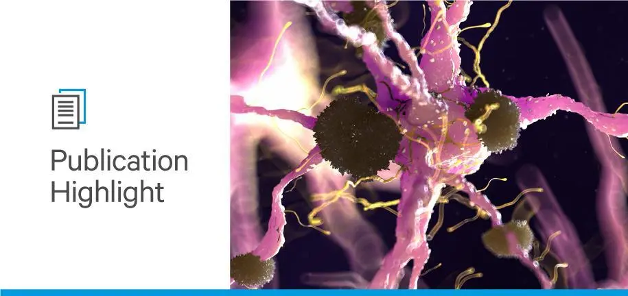 The Sialylation Pathways In Pancreatic Cancer And Their Role In Tumor ...