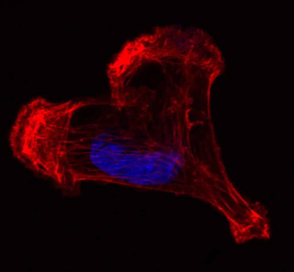 RosaFontana MDA cytoskeleton RF 2