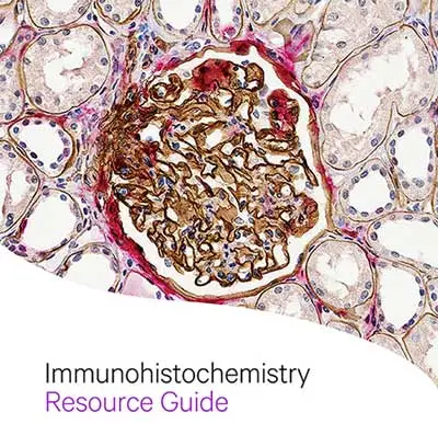 Immunohistochemistry brochures home page