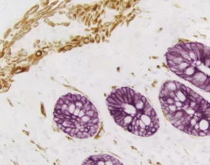 VECTASTAIN Blog Post Image 1 300x236 1 VECTASTAIN Blog Post Image 1 300x236 1