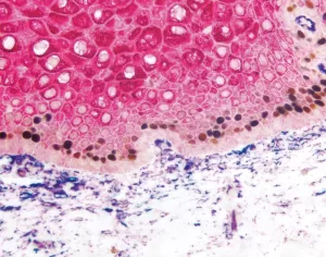 VECTASTAIN Blog Post Image 2 300x236 1 VECTASTAIN Blog Post Image 2 300x236 1