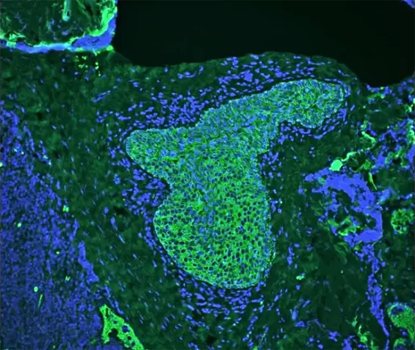 BR autofluorescence quencher pic1 600x506 1