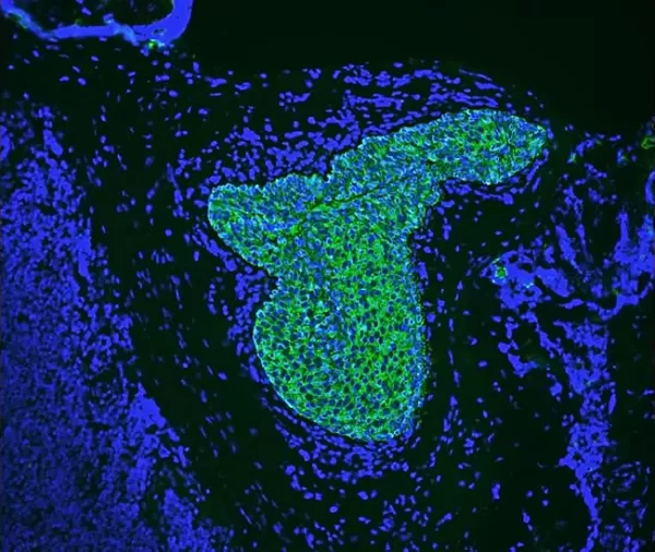 BR autofluorescence quencher pic2 600x506 1
