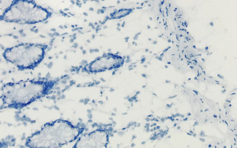 BR endogenous enzyme pic2 768x481 1