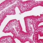 Prostate: Anti-PSA (mouse monoclonal, VP-P981), ImmPRESS™ AP Anti-Mouse Ig Reagent (MP-5402), ImmPACT™ Vector® Red Alkaline Phosphatase Substrate (SK-5105), viewed under brightfield microscopy.