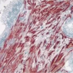 Prostate: Smooth muscle actin (m), ImmPRESS Anti-Mouse Ig Kit, AEC Substrate Kit (red). Hematoxylin QS counterstain (blue). Mounted in VectaMount AQ Mounting Medium.