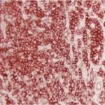 Tonsil: LCA (m), ImmPRESS Reagent (HRP), ImmPACT AMEC Red (red).