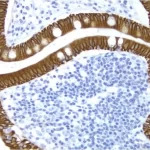 Small Bowel: Cytokeratin 8/18 (m), ImmPRESS Anti-Mouse Ig Kit, DAB Substrate Kit (brown), Hematoxylin QS (blue).