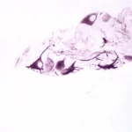 Small Bowel: Neurofilament 200kD (m), ImmPRESS Anti-Mouse Ig Kit, Vector VIP Substrate Kit (purple).