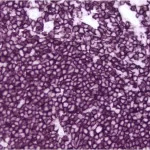 Tonsil: CD20 (m), ImmPRESS Anti-Mouse Ig Kit, ImmPACT VIP (purple) substrate.