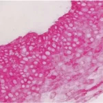 Tonsil: Cytokeratin AE1/AE3 (m), ImmPRESS-AP Reagent,
