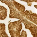 Prostate: Prostate Specific Antigen (m), ImmPRESS Reagent (HRP), ImmPACT DAB (brown).