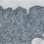 Tonsil: Cytokeratin AE1/AE3 (m), ImmPRESS Reagent (HRP), ImmPACT SG (blue-gray).