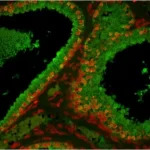 Prostate: Prostate Specific Antigen (rp), fluorescein labeled using the ProtOn Fluorescein Labeling Kit. Propidium Iodide counterstain (red). Mounted in VECTASHIELD HardSet Mounting Medium.