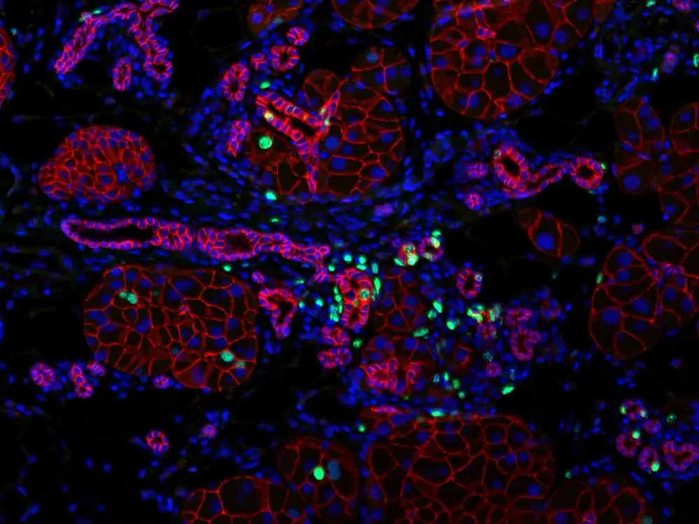 14days after pancreas injury 20X DAPI EdU Ecadherin 1520x1120 1