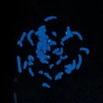Single copy DNA probe to the Downs region of chromosome 21 using FITC-labeled antibody (green) and mounted in VECTASHIELD Mounting Medium with DAPI (blue) - Photo courtesy of Cytocell Ltd.