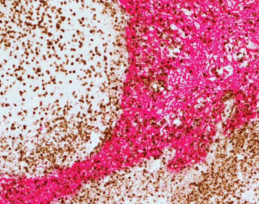 2 Human Tonsil 1000x786
