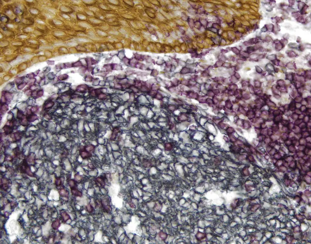 2 Tonsil Vectastain elite 1000x786 1