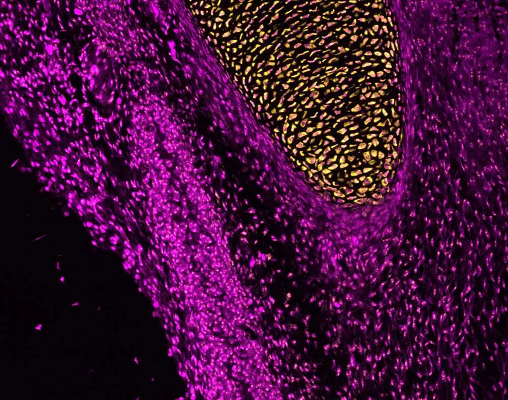 4 Expression Col2a1 1000x786 1