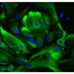 Astrocytes: Stained for GFAP and detected with Dylight 488 labeled secondary antibody. Mounted in VECTASHIELD HardSet Mounting Medium with DAPI. Image courtesy of Dr Emma East, Department of Life Sciences, The Open University, U.K.*