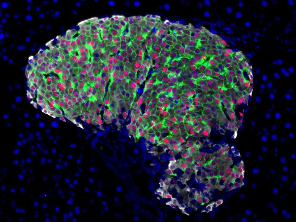 Adult islet 20X DAPI Glut2 MafA Insulin 1520x1140 1