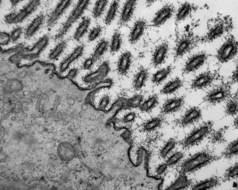Glycocalyx on endometrial cells.cropped
