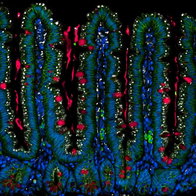 KEngevik Intestine KEngevik Intestine