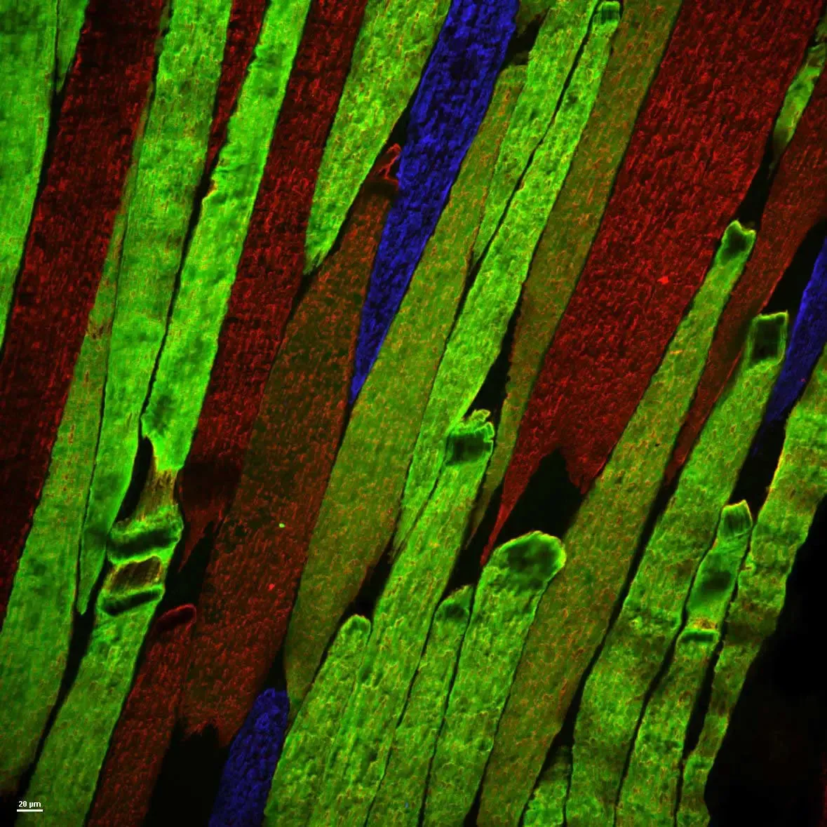 Keri.Gardner.12130 DF BGRfibertype