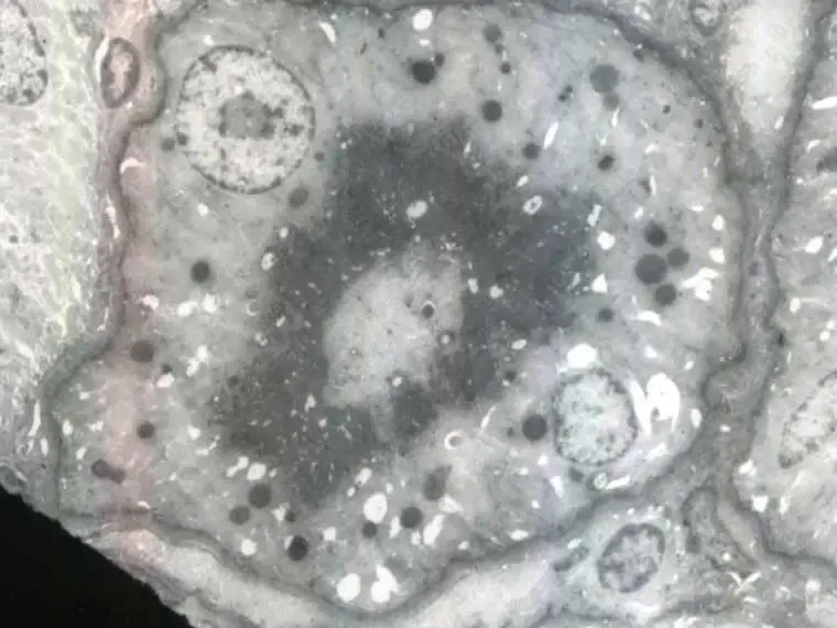 LectinePHAkidneya.cropped
