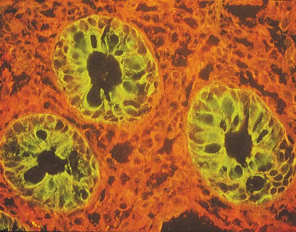 Lectins Image1 1000x786 Lectins Image1 1000x786