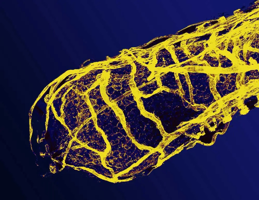 MarnaEricson vascular network 2
