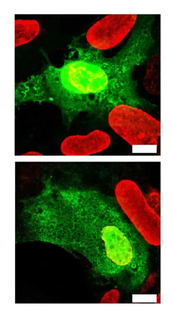 NC fibroblast figure4 01