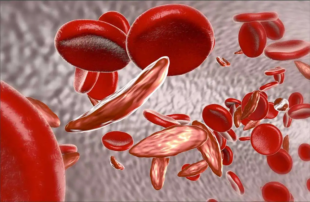RedBloodCell RedBloodCell