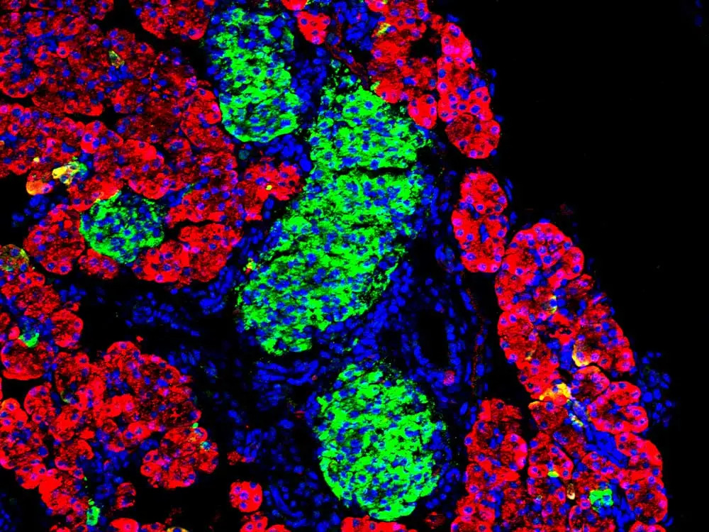 WT P7 20X DAPI Tff2 Insulin 1520x1140 1