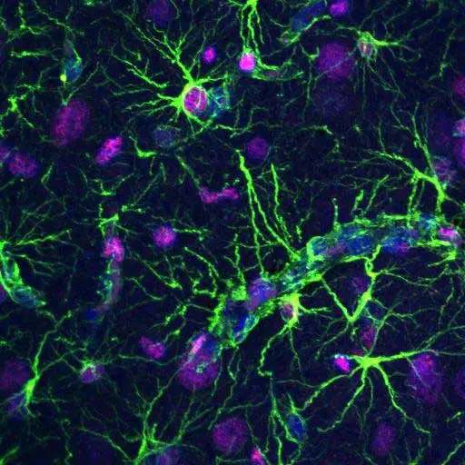 Zhengming.Wang .IF GFAP v PCNA Confocal