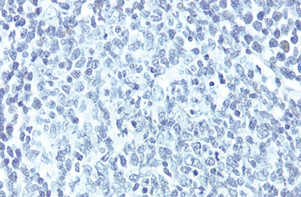 antigen retrieval figure1a 1024x671 1