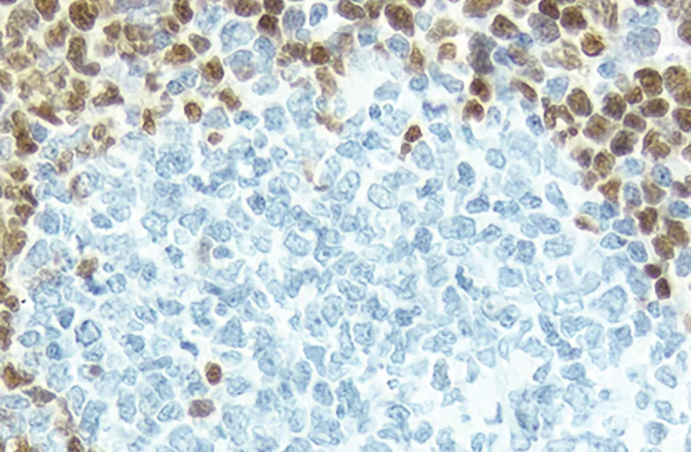 antigen retrieval figure1b 768x503 1