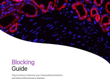 blocking guide cover 1