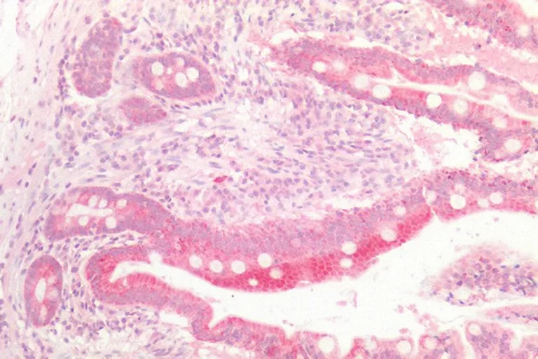 cancer IHC plus antibody 768x512 1