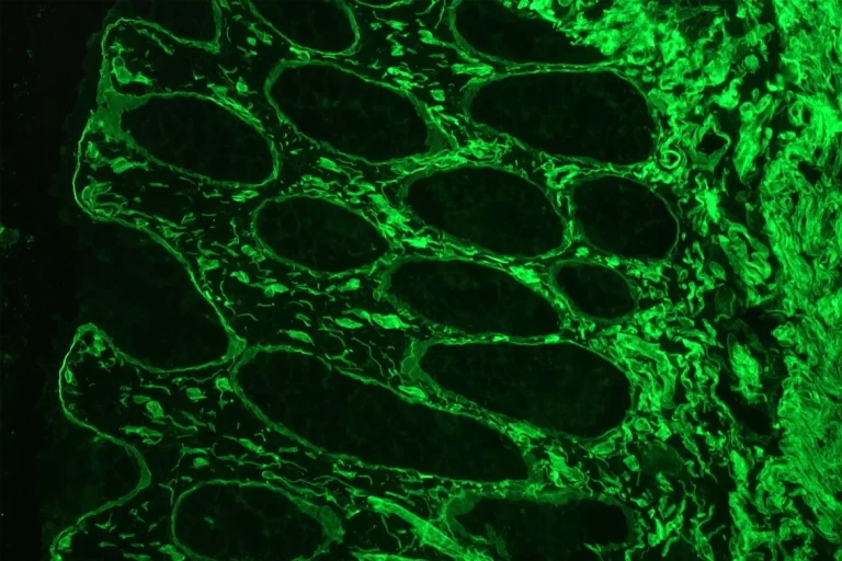 cancer anti laminin rat antibody 768x512 1