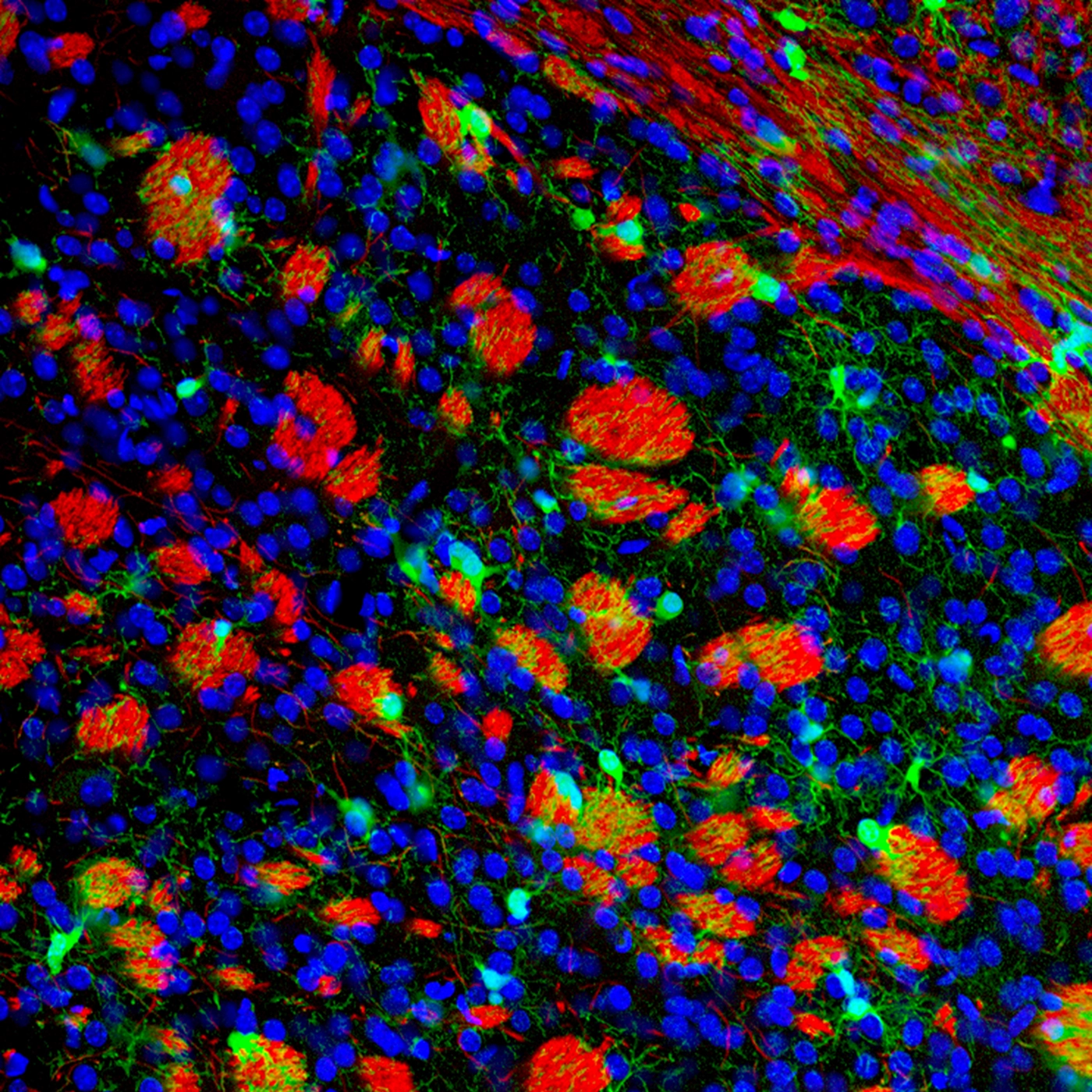 cancer research 01