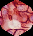 ihc why icon 02