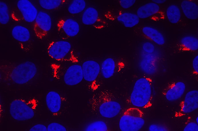 infectious disease dsRNA pic