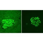 Adjacent sections of Human Pancreas FFPE tissue stained for insulin using fluorescein label (green) and mounted with VECTASHIELD Vibrance Antifade Mounting Medium. Note significant reduction of autofluorescence in treated section (right).