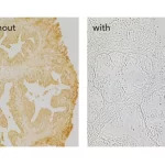 Prostate without and with R.T.U. Animal Free Block and Diluent used in the blocking step. Both sections are no primary antibody controls with Biotinylated Universal Secondary Antibody