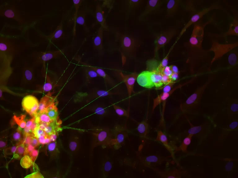 Secondary Antibodies 10 secondary antibodies pic2 768x575 1
