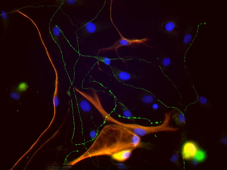 Secondary Antibodies 11 secondary antibodies pic3 768x575 1