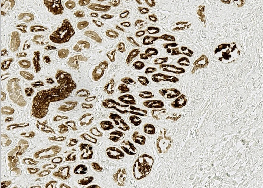 Species-On-Species 9 sos hoh kidney pic2 1024x732 1