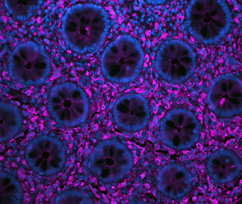 Immunofluorescence 1 if what sec pic