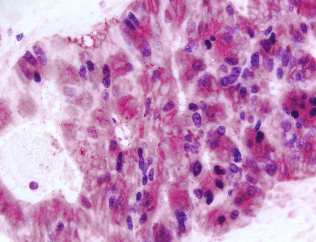 ihc recombinant atibodies bckgr